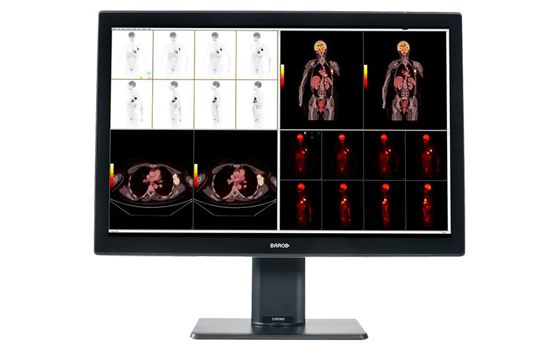 Radiology monitors