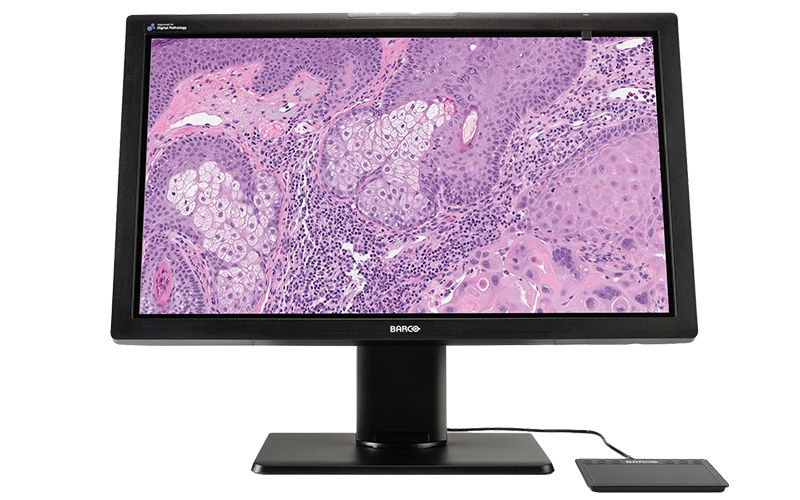 Digital pathology monitors