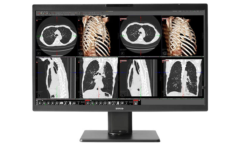 Try medical display remote readings