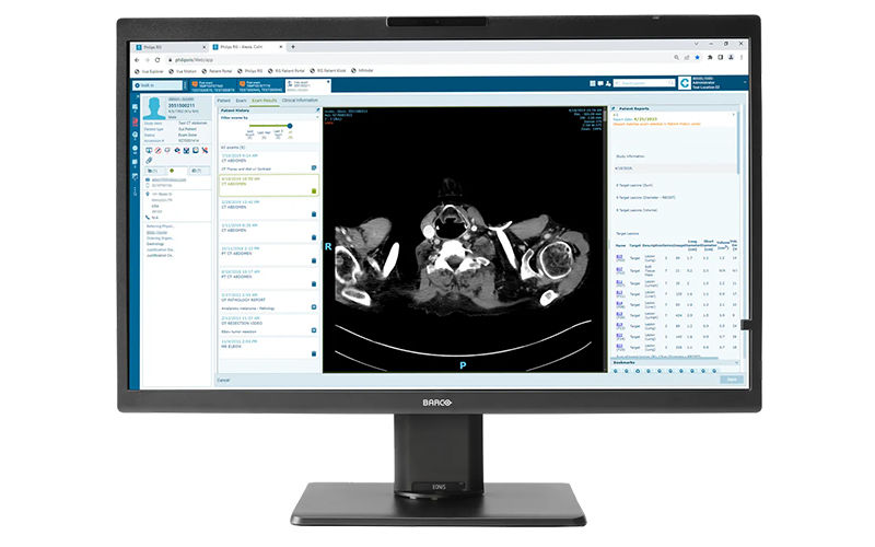 Affordable & reliable medical monitors