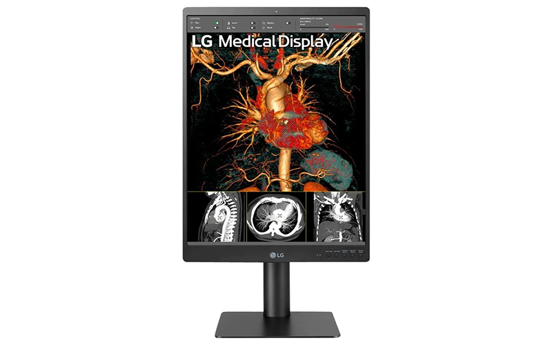 Get high picture quality and resolution anywhere with LG TVs.Make more confident medical decisions with LG® surgical monitors. LG Medical Monitor